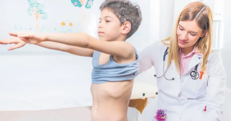 Her 100 çocuktan 3 ü skolyoz riski taşıyor
