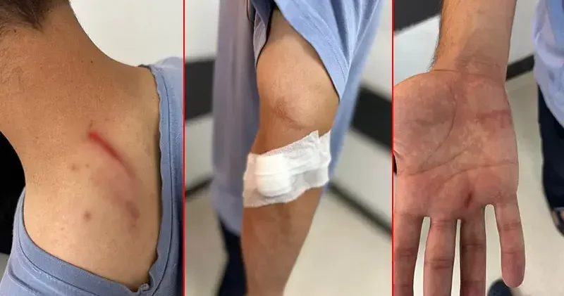 İlaç raporu tartışmasında tıbbi sekreteri darbetti