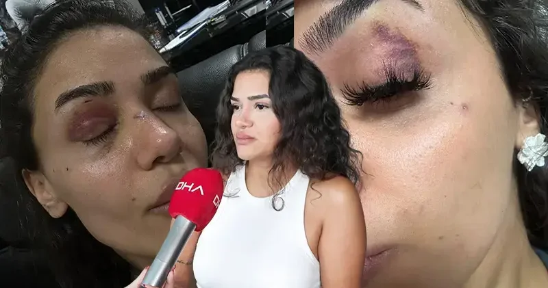 Bahçeşehir de uzaklaştırma kararına rağmen evinin önünde darbedilen Ebru: Ölmeden önce sesimi duyun