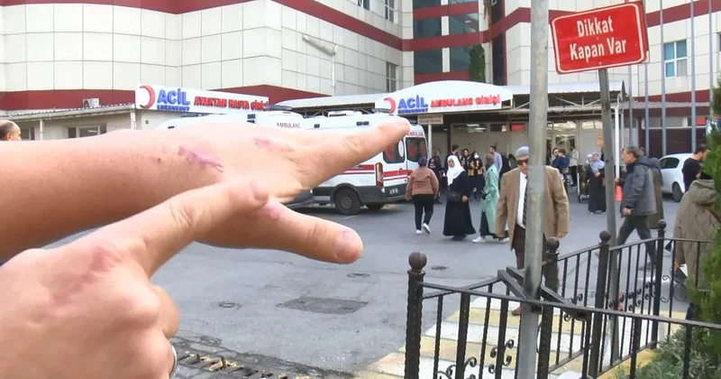 Esenyurt’ta başına öyle bir olay geldi ki: Dünyada bir ilk! Meğer kedisi ısırınca…