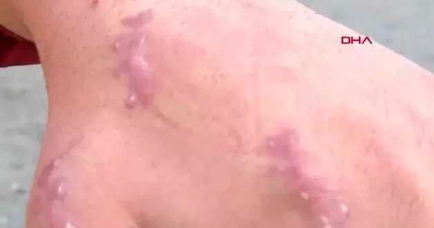 Bu vaka dünyada ilk olabilir! Elini ısıran kedi genç adamın kabusu oldu