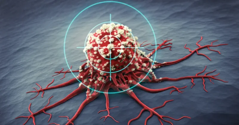Kanserde en kritik dönem sessiz geçiyor! İşte dikkat etmeniz gereken 5 belirti