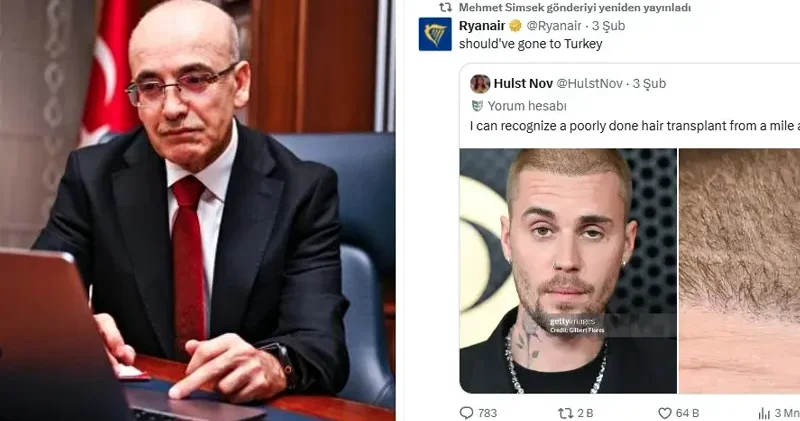 Bakan Şimşek ten bir saç ekimi paylaşımı daha; Türkiye’ye gitmeliydi