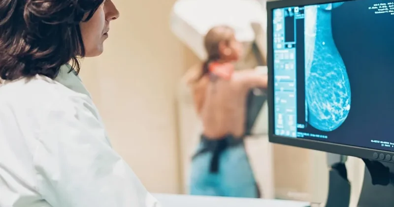 Kadınlarda en sık rastlanılan kanser türü: 2050’ye kadar 3,5 milyona çıkabilir