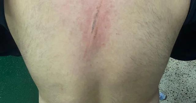 Maç öncesi ortalık karıştı: Futbolcular kramponlarla darbedildi Osmaniye Haberleri