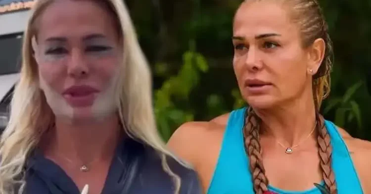 Survivor’dan döner dönmez soluğu orada aldı! Nagihan Karadere estetik yaptırdı