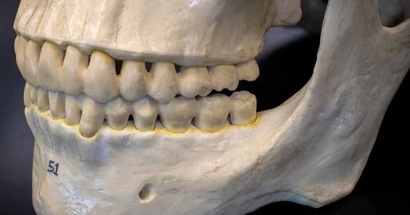 Tarih kitapları değişiyor! 2 milyon yıllık diş minesindeki protein , kuzenlerimiz hakkında bildiğimiz her şeyi altüst Sözcü Gazetesi