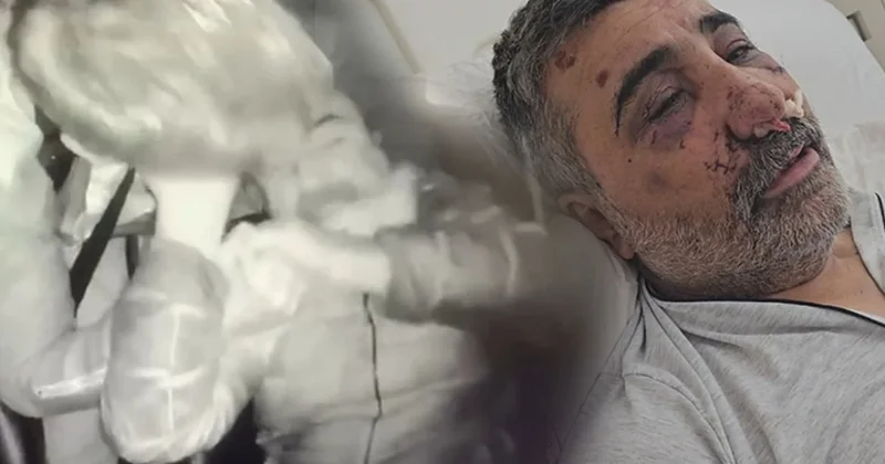 Taksiciyi öldüresiye dövdü: İngiliz boksörün mahkemedeki ifadesi ortaya çıktı Sözcü Gazetesi