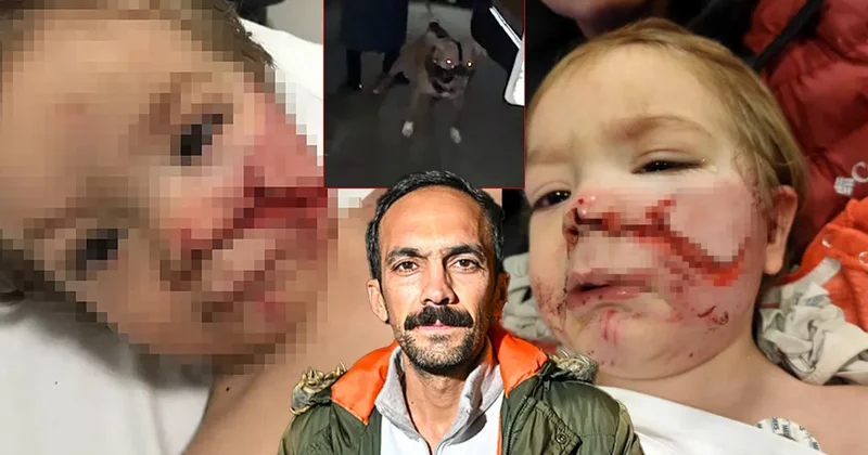 SON DAKİKA… Ankara’da pitbull saldırısı sonucu ölümle burun buruna gelmişti! 1,5 yaşındaki Efe Öztürk ailesiyle buluştu