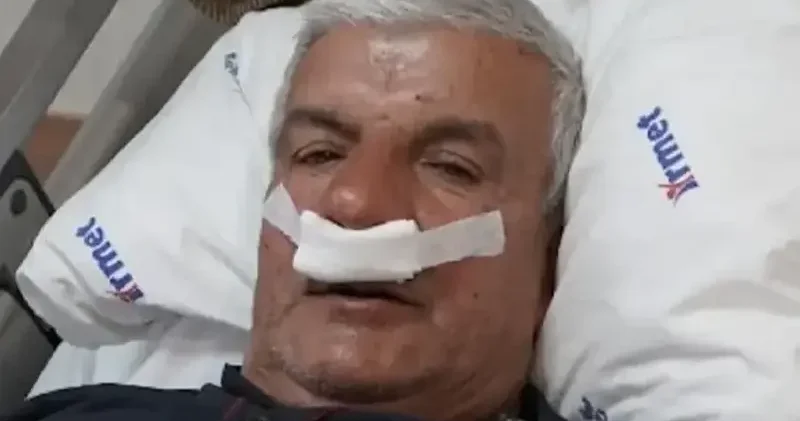 Yıllarca burnu tıkalı yaşadı: 65 yaşındaki adamın burnundan 100 gram taş çıktı Aktüel Haberleri