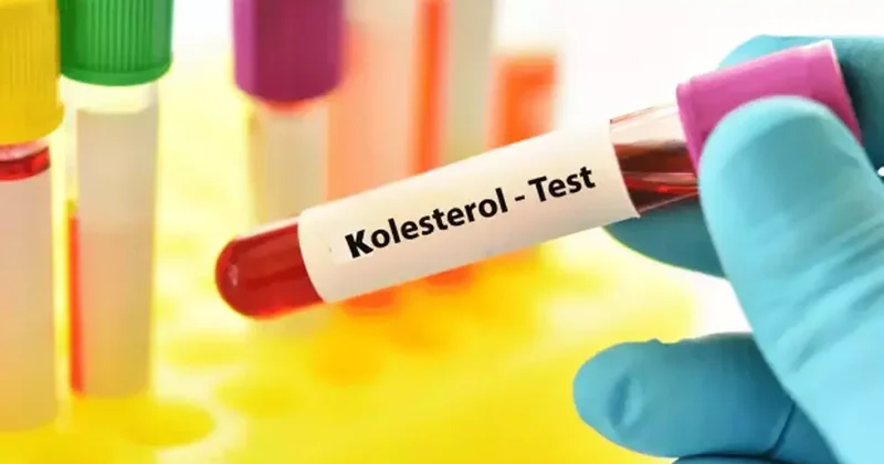 Kolesterolünüzü düşürüyor! Bu besinler imdadınıza hızır gibi yetişiyor