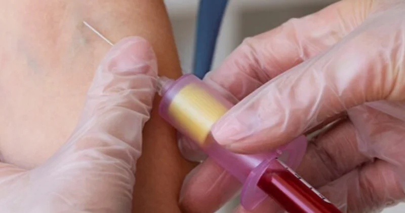 Bu kan grubuna sahip kişilere acil uyarı yapıldı Sözcü Gazetesi