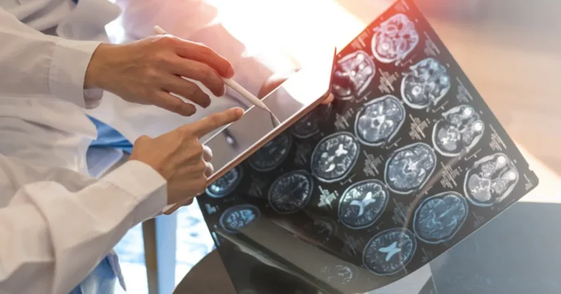 Beyindeki kötü anılar silinebilir mi? Bilim insanlarından çarpıcı açıklamalar