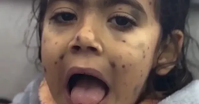 Gazzeli Meryem kan kusuyor: Babasından tedavi için tahliye çağrısı VİDEO İZLE