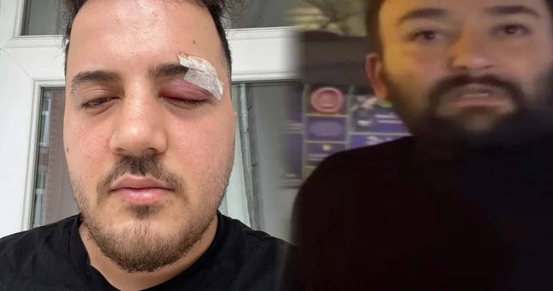 Tartıştığı sürücüye ölüm tehditleri savurup darbetti! Kamerayı görünce tanımazlıktan geldi