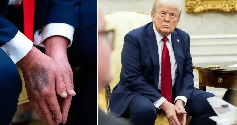 ABD Başkanı Donald Trump hasta mı, hastalığı ne? Hastaneye mi kaldırıldı? Beyaz Saray açıklama yaptı Amerika Haberleri