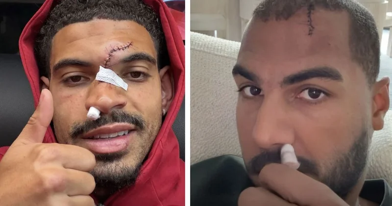 Kafa kafaya çarpışan Morgan Gibbs White ve Robert Sanchez in yüzünün son durumu korkuttu