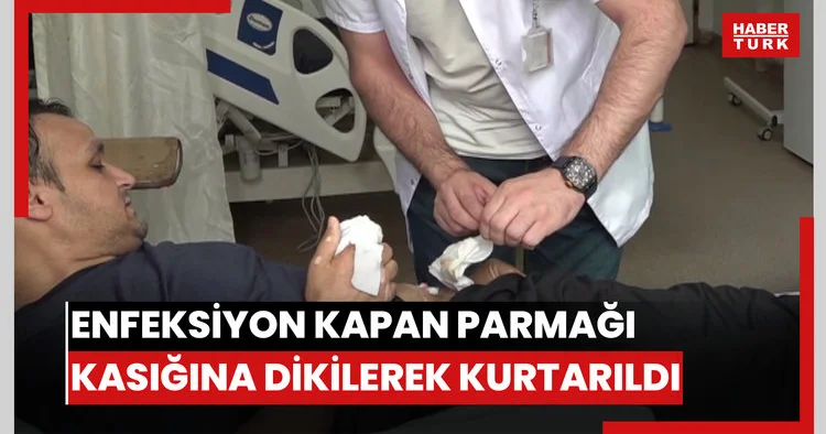 Enfeksiyon kapan parmağı kasığına dikilerek kesilmekten kurtarıldı