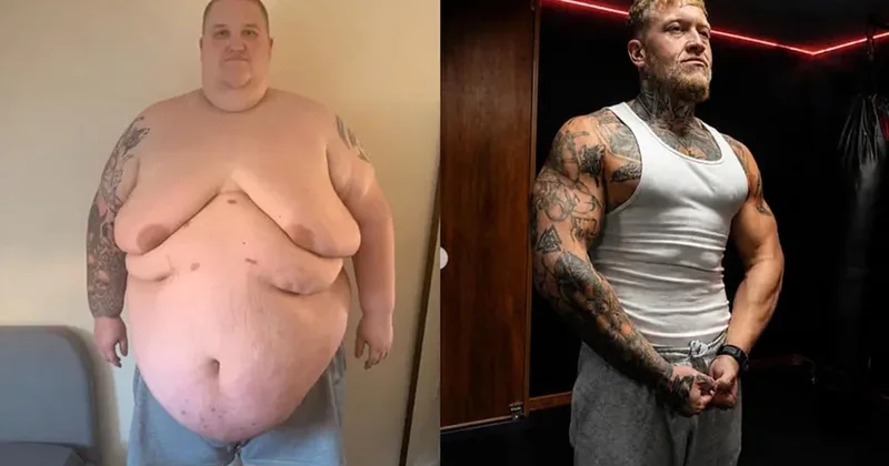 Tamı tamına 193 kilo verdi! Günde 10 bin kalori alıyordu Sözcü Gazetesi