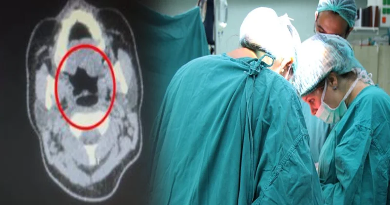 Midesinden çıkan doktorları şoke etti: Tam yarım kilo! Sözcü Gazetesi