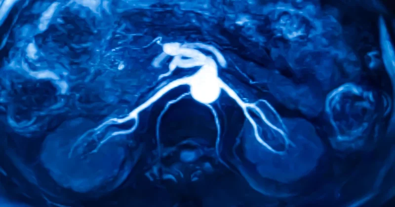 Gizemli kanser artışını araştıran gazeteci 29 yaşında hastalığa yakalandı... ‘Sağlık editörü olmama rağmen bu belirtileri ben bile kaçırdım