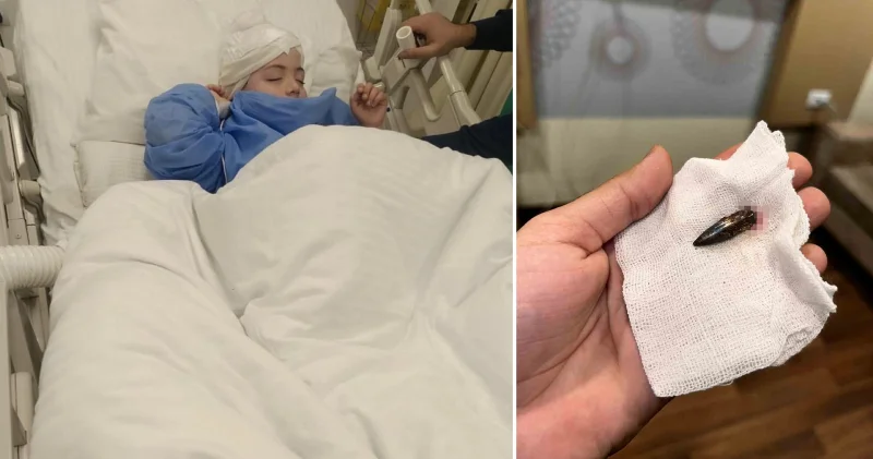 Gazzeli Awad 1,5 yıldır kafasında taşıdığı mermiden Türk yardımseverlerin desteğiyle kurtuldu Aktüel Haberleri