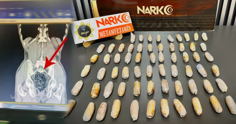 Şüpheli hareketler yakayı ele verdi: Yolcunun midesinden 472 gram uyuşturucu çıktı