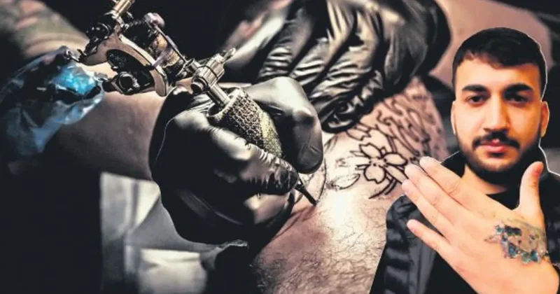 Dövmesini sildirmek isterken elinden oldu