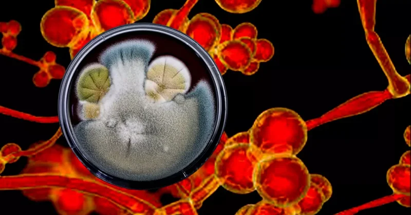 ABD alarm verdi 60 ülkede görüldü: İlaçlar bile çözüm olmuyor! Ölümcül mantar hastalığı korku saçıyor