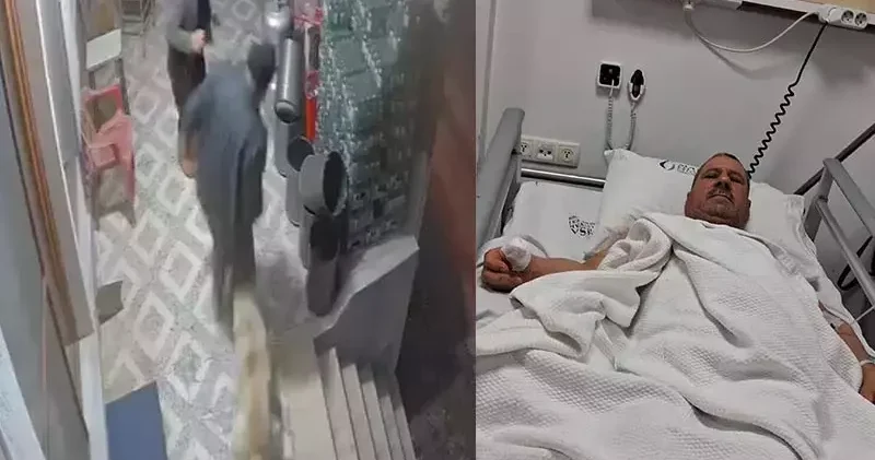 Köpek saldırısına parmağı koptu; o anlar kamerada