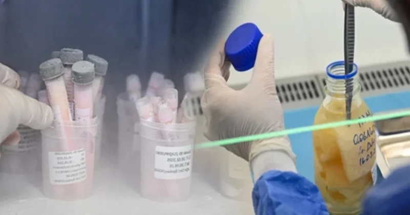 Ölen insanların derileri Türkiye deki bu merkezde saklanıyor! Sözcü Gazetesi