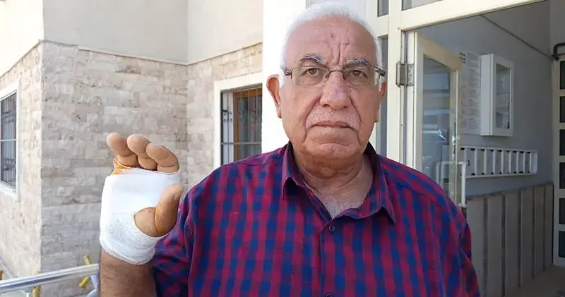 Komşusunun ısırdığı parmağı ampute edildi