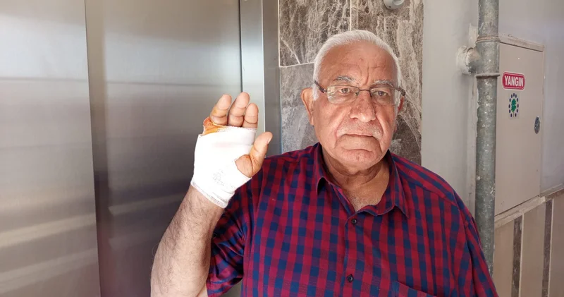 SON DAKİKA: Komşusunun parmağını ısırıp koparttı Hatay haberleri Son dakika haberleri