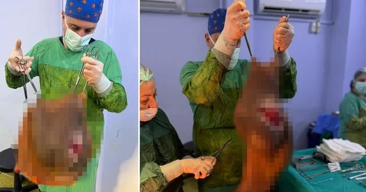 Aydın da 67 yaşındaki karnından 40 kilogram kitle çıkarıldı