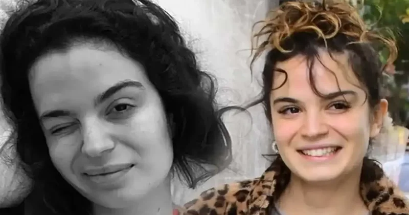 Aslı Bekiroğlu ndan nazar isyanı: Düz yolda düştüm kaslarım yırtık!
