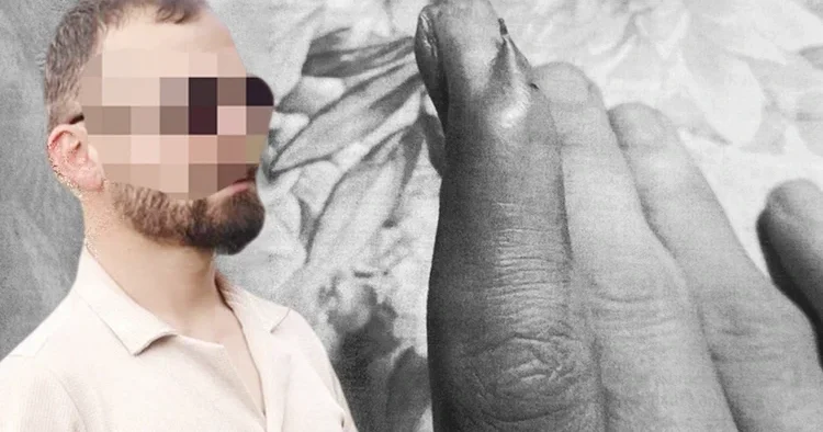 Çıkarılamayan iğne için ihmal davası