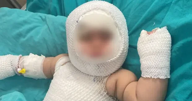 Mersin haberleri Mersin de konserve domates faciası! 9 aylık bebek yandı 06 Ağustos 2026