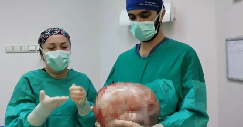 2 ayda 9 aylık hamile gibi büyüdü, doktorlar görünce apar topar ameliyata aldı