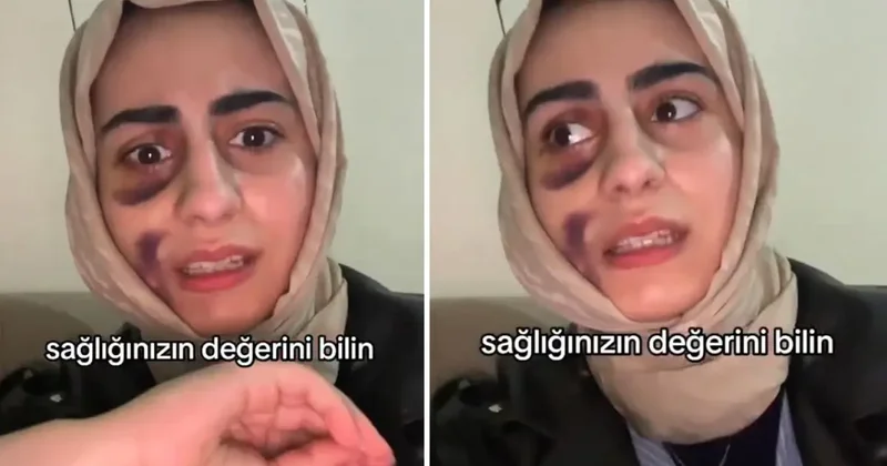Stajyer doktora tedavi olan kadın video çekip isyan etti