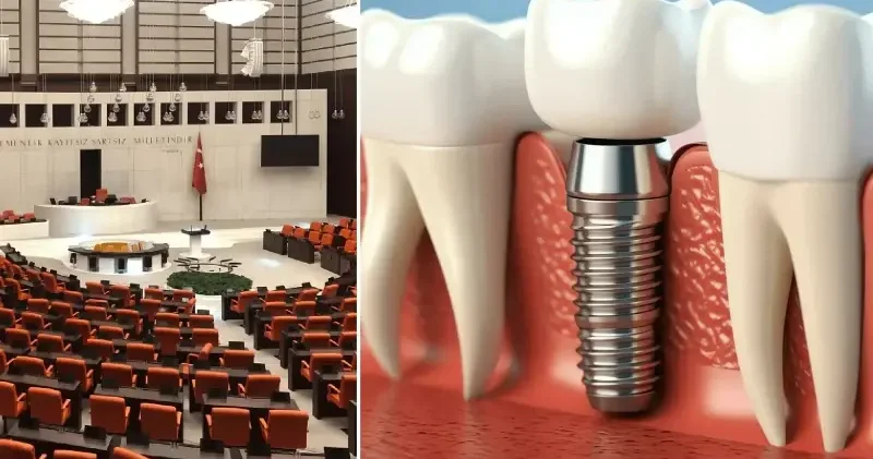 Milyonları ilgilendiren teklif Meclis e sunuldu: İmplant tedavisini SSK karşılayacak Politika Haberleri