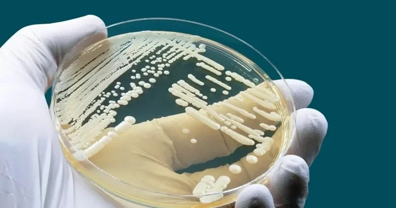 Dünya alarmda! 6 kıtaya yayıldı, ilaç fayda etmiyor: Ölümcül mantar kabusu büyüyor