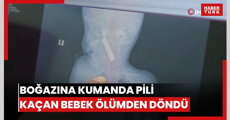 Boğazına kumanda pili kaçan bebek ölümden döndü