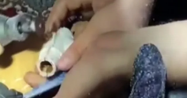 Adana da parmağını kombi borusuna sıkıştırdı VİDEO İZLE