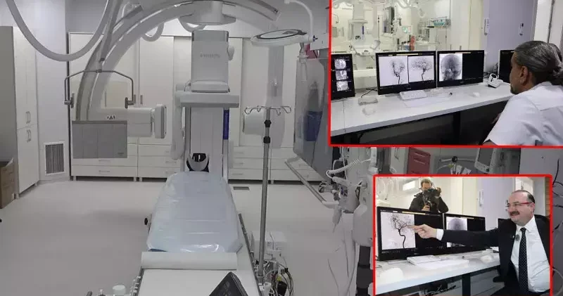 Yeni nesil anjiyografi cihazı, felç ve beyin tıkanmalarının önünü geçecek