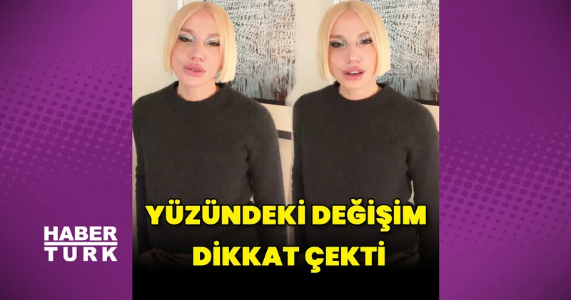 Gülşen in yüzündeki değişim dikkat çekti Magazin haberleri