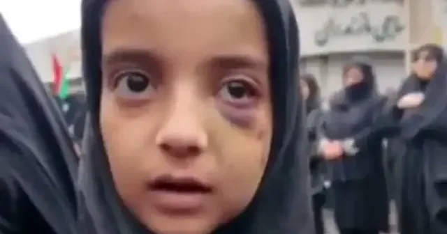 ABD İsrail saldırısından kurtulan çocuk: Annemi kurtaracağım dedi şehit oldu VİDEO İZLE