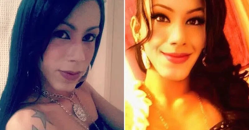 Güzellik uğruna yüzü tanınmaz hale geldi! Yine akıllanmadı