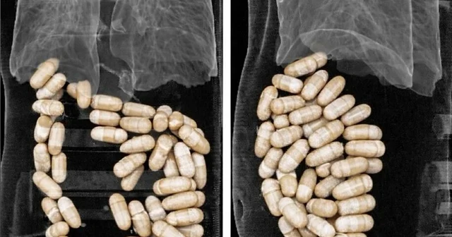 2 şüphelinin midesinden 127 kapsül uyuşturucu çıktı İzmir Haberleri