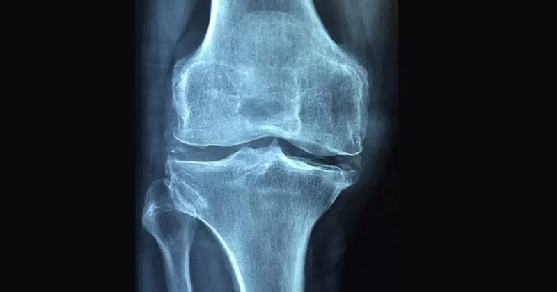 Dikkat! Sessiz ilerliyor: Ölüme kadar götürebilir