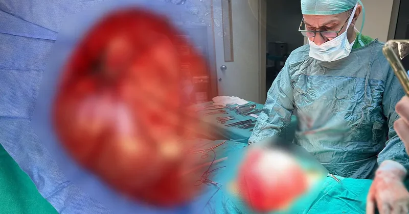 Kilo vermek istemişti: 14 yaşındaki çocuğun karnından çıktı!